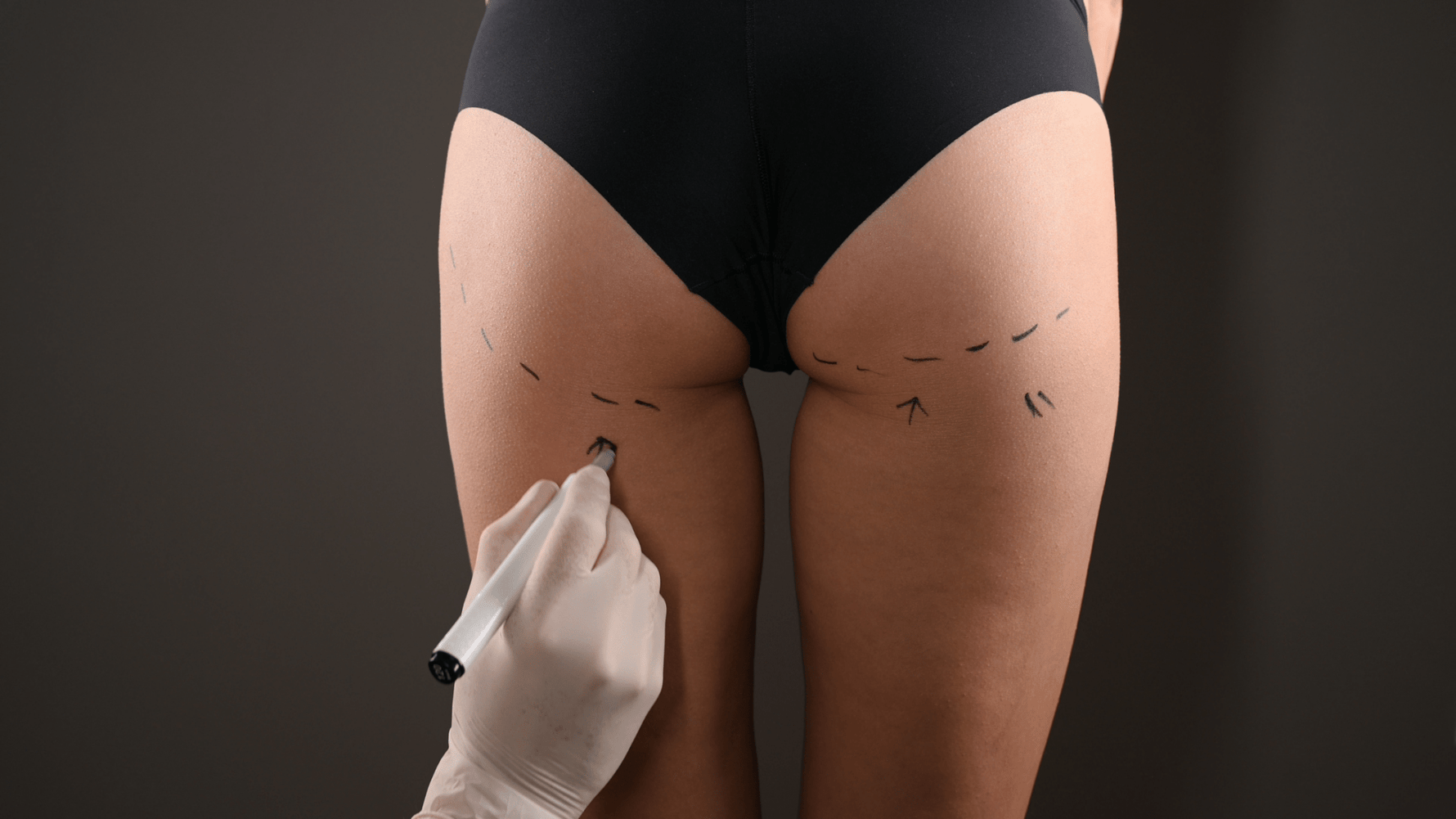 Brazilian Butt Lift: What to Expect, Surgery, Recovery & Risks - Bombshell Booty Pillow