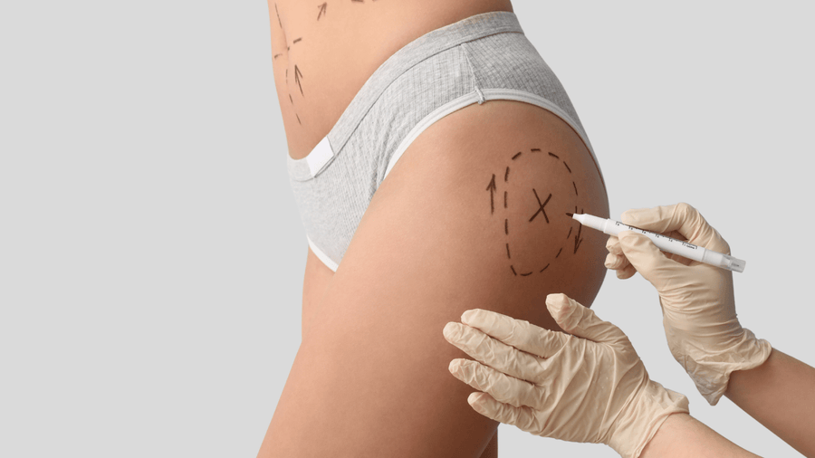 How Painful is BBL Recovery-All You Need To know – Bombshell Booty Pillow